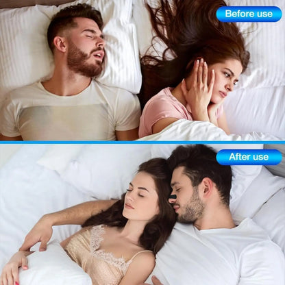 Nasal Breathing Strips